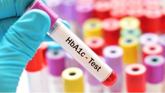 ما هو اختبار الهيموجلوبين السكري (HbA1c)؟