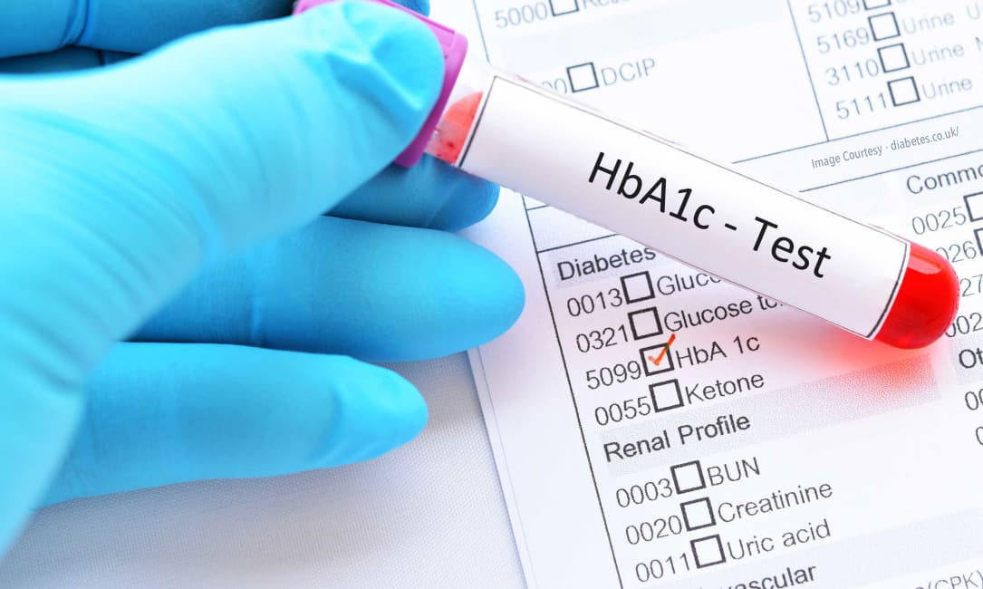 اختبار HbA1c لمجموعات سكانية مختلفة